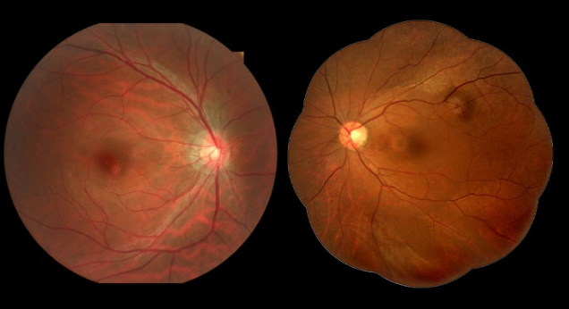 SYSEYE RetiCam 3100 Digital Fundus Camera