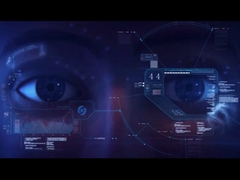 optical biometer eye axial length view
