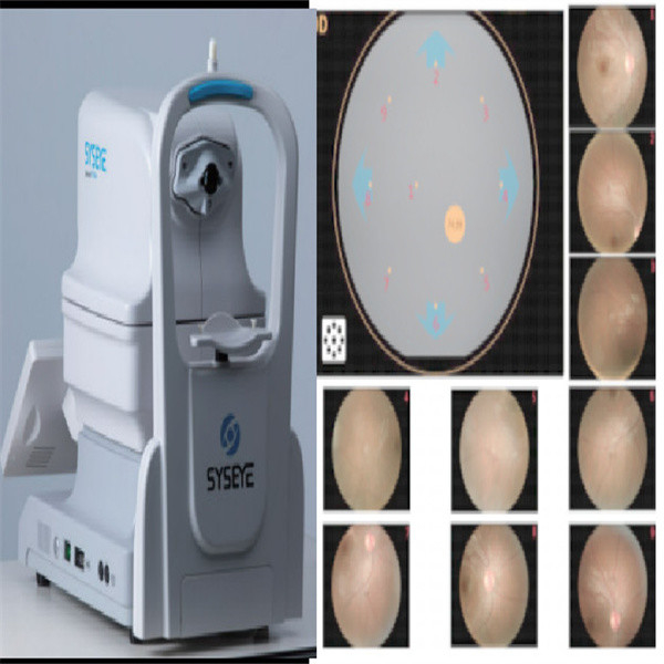 Non Mydriatic Fundus Camera with 13mm Working Distance 35mm Operating Distance and 50° Field of View for High-Definition Retinal Imaging