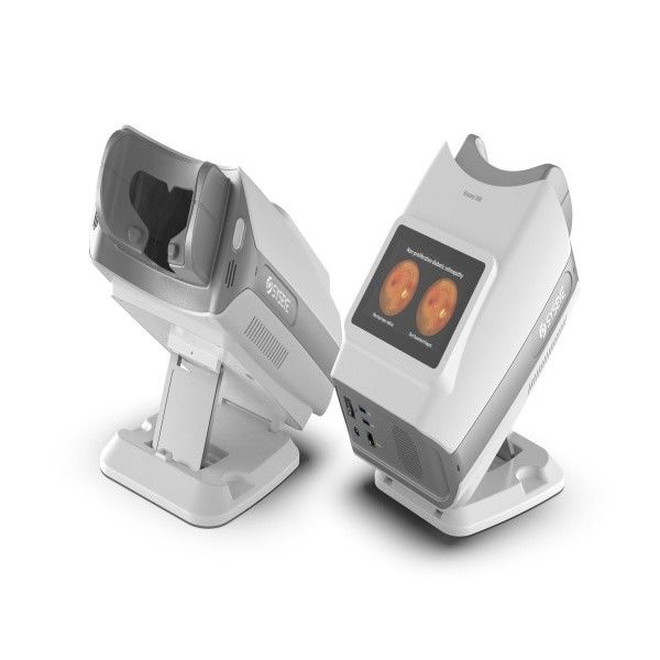  Portable Non-Mydriatic Fundus Camera for Retinal Screening (Kestrel 300) - Fully automatic portable retinal imaging device for primary eye clinics and screening projects