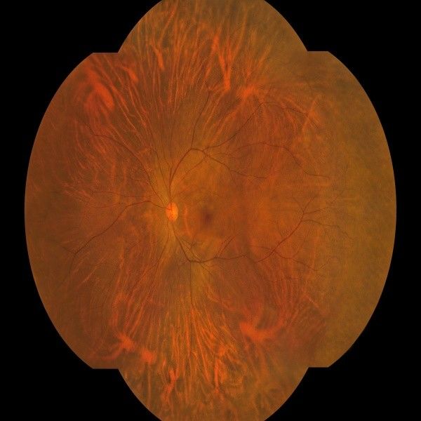 176° Wide Field Fundus Camera with 27-inch Color Monitor and 8μm Optical Resolution for High-Definition Retinal Imaging