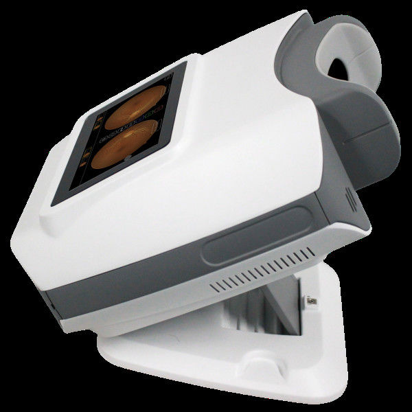  Portable Non-Mydriatic Fundus Camera for Retinal Screening (Kestrel 300) - Fully automatic portable retinal imaging device for primary eye clinics and screening projects