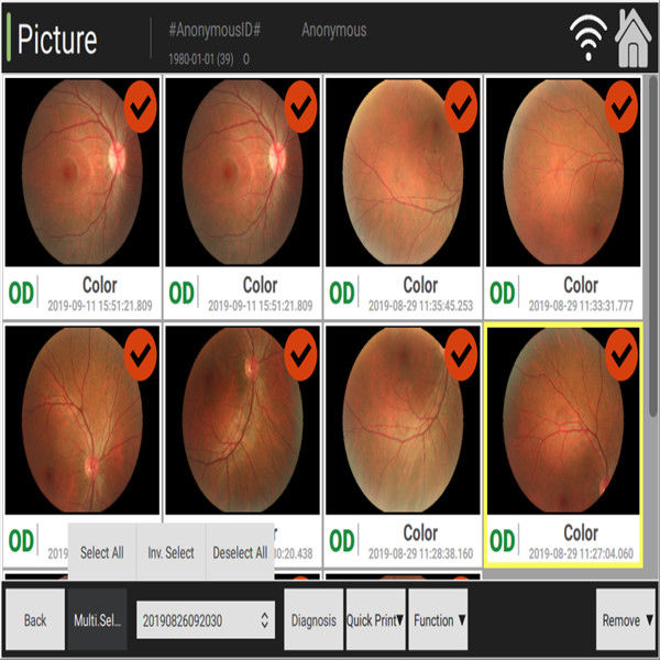 3.3mm Automated Fundus Camera Observing Color Change Of Optic Nerve Atrophy